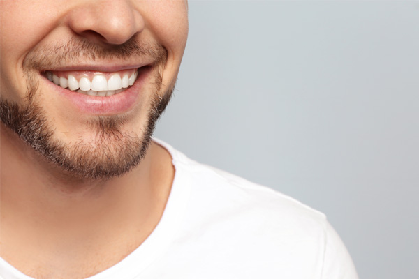 Teeth Whitening and why you should only see a Dentist